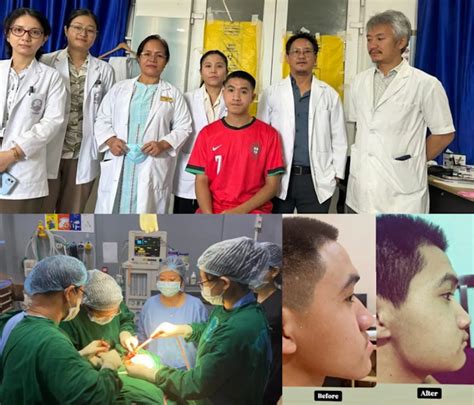 TRIHMS Performs Arunachal’s First Bi-Jaw Surgery, Marks Major Leap in ...