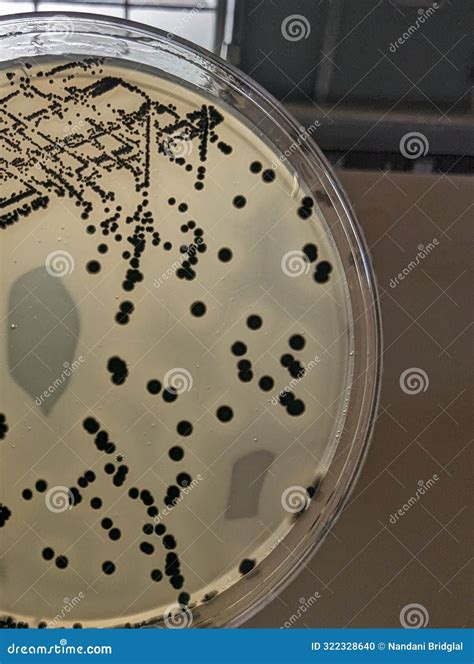 Quadrant Streak of Staphylococcus Aureus on Baird Parker Agar Plate ...
