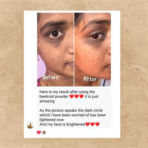 Beetroot Powder 25g ( Pack Of 3 ) - Araah Skin Miracle