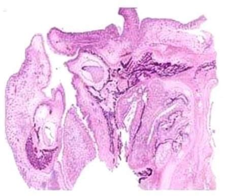 Oral Embroylogy Slides Face Development Slide Manufacturer Supplier ...