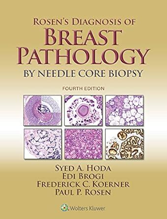 Rosen's Diagnosis of Breast Pathology by Needle Core Biopsy eBook ...