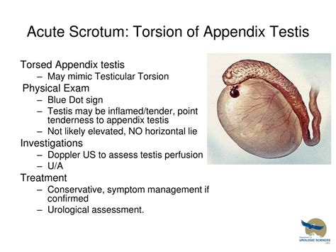 Torsion Of Appendix Testis