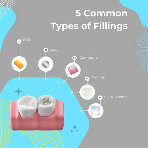 Best Fillings for Teeth To Maintain Your Smile — KWC Dental