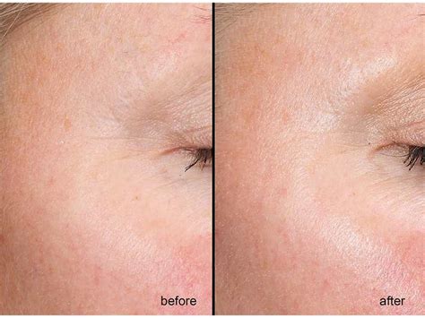 OPULUS Beauty Labs Retinol+ Ramp-Up Starter System | LovelySkin