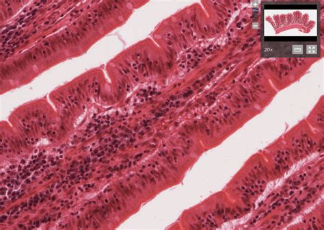 Image result for Small Intestine Jejunum