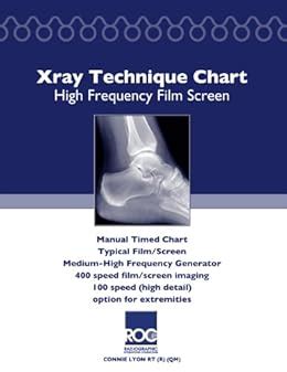Xray Technique Chart High Frequency Film Screen eBook : Lyon RT (R) (QM ...