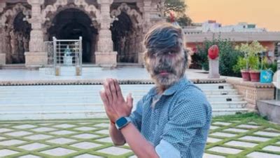 Meet Lalit Patidar: The Indian teen who suffers from the werewolf ...