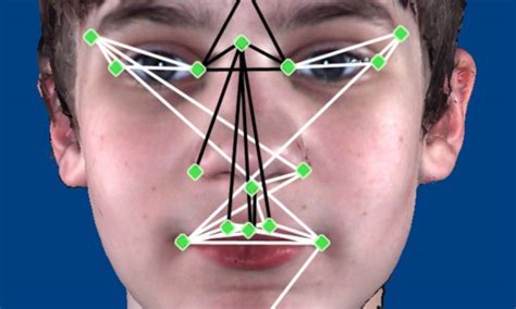 Image result for Autistic Face Features