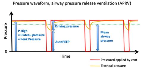Image result for APRV Mode Explained