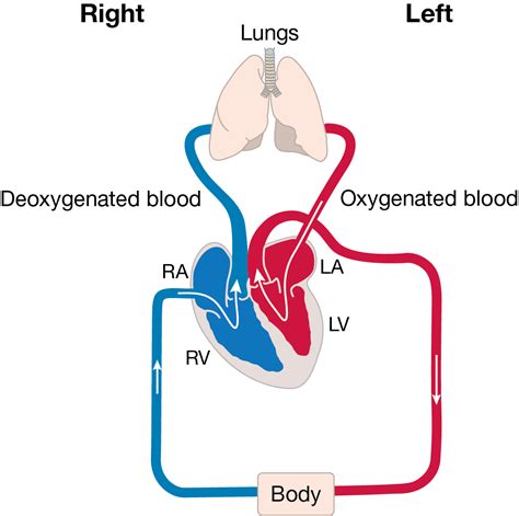 Double Outlet Right Ventricle (DORV) | Little Hearts Matter