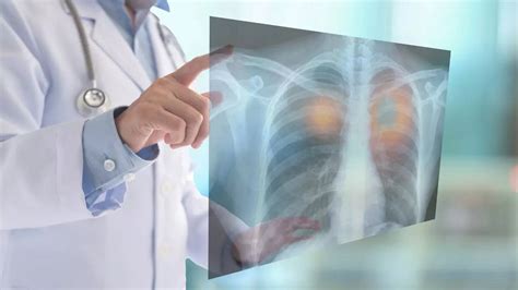 World Lung Cancer Day 2023: Lung cancer happens because of this Know ...