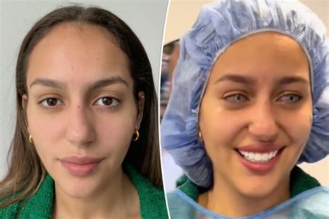 Image result for Eye Color Change Procedure