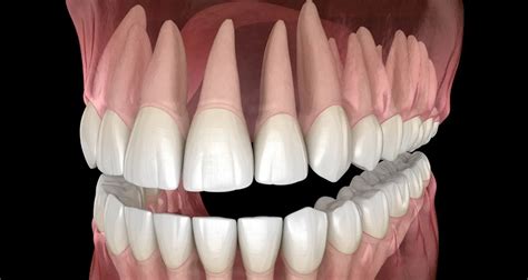 Image result for Tooth Eye Connection