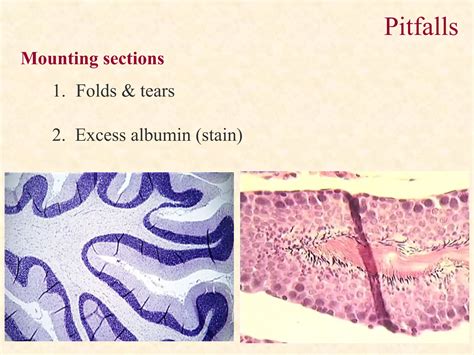 Tissue Processing in Histopathology 的图像结果
