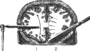 Image result for Playwright Test Code Example