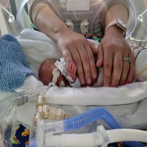 Miracle baby born in 5 months weighed just half kg tomatoes without ...