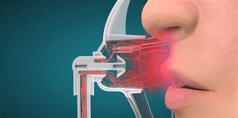 OxyMask O2 的图像结果