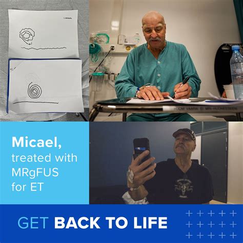 Image result for Insightec Essential Tremor