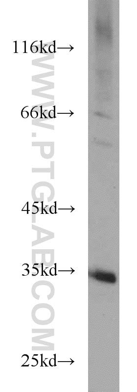 ECH1 antibody (11385-1-AP) | Proteintech
