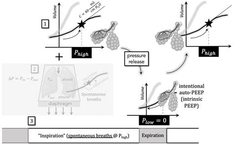 Aprv Pressure Time Graph 的图像结果