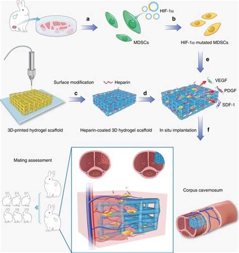 Image result for Angion Method Review