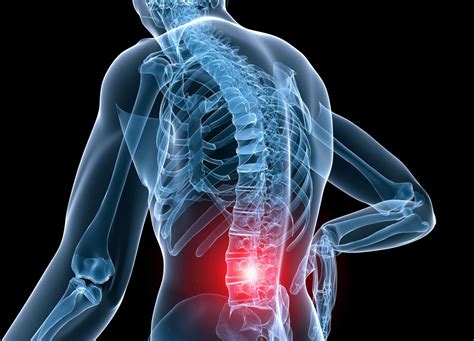 An Overview Of Vertebral Pain Syndrome - El Paso, TX | Sciatica Pain and Treatment Clinic