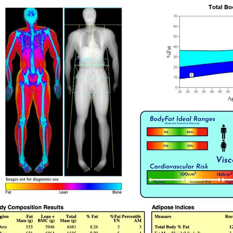 DEXA Scan | Private DEXA Body Scans in London, UK | My Vital Metrics