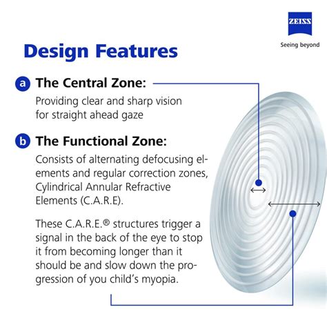 Benefits Of Zeiss Lenses