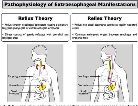 Image result for Vagus Nerve Function