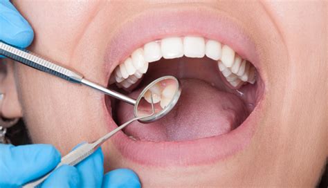 11 Health Benefits of Eating Yogurt - lifeberrys.com