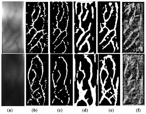 Finger-Vein Verification Based on Multi-Features Fusion