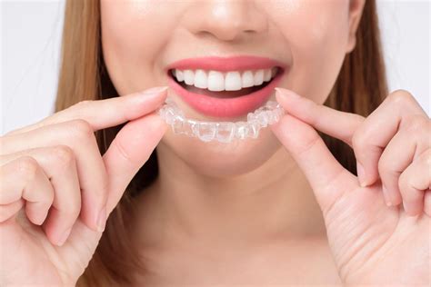 Image result for Invisalign Scanning Step by Step