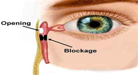 Om Sattva Charitable Trust