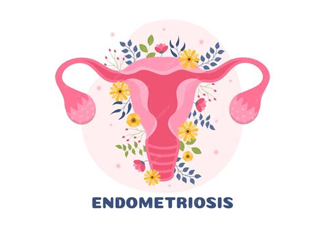Uterine Wall