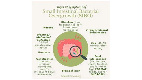 What Causes Sibo