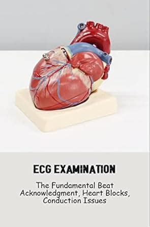 Ecg Examination: The Fundamental Beat Acknowledgment, Heart Blocks ...