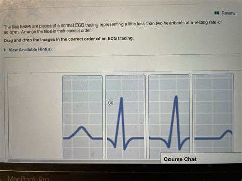 Normal ECG Read Out 的图像结果