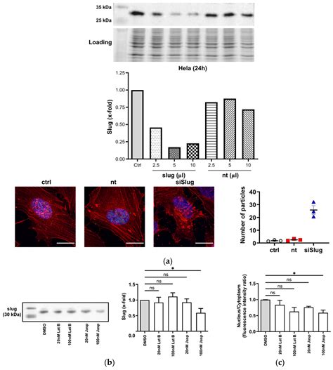 A Novel Interaction of Slug (SNAI2) and Nuclear Actin