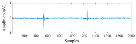 A Novel Denoising Method for Partial Discharge Signal Based on Improved ...