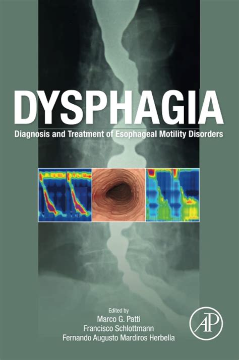 Buy Dysphagia: Diagnosis and Treatment of Esophageal Motility Disorders ...