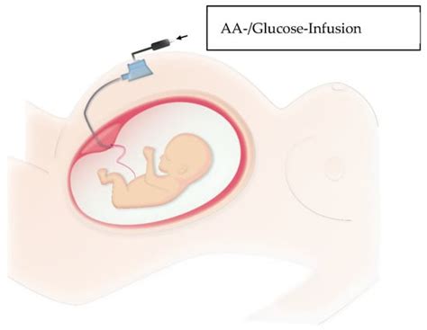 A Study of the Literature on Intrauterine Treatment Options for Chronic ...