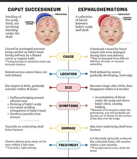 #caputsuccedaneum #cephalohematoma #neonatology #pediatrics #childbirth #healthcareeducation # ...