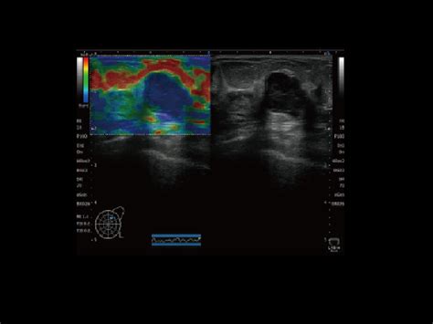 SONIMAGE HS2 - Konica Minolta