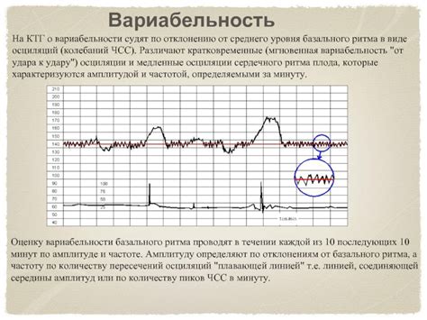 Кардиотокография (КТГ)