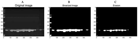 A New Algorithm for Detecting GPN Protein Expression and Overexpression ...