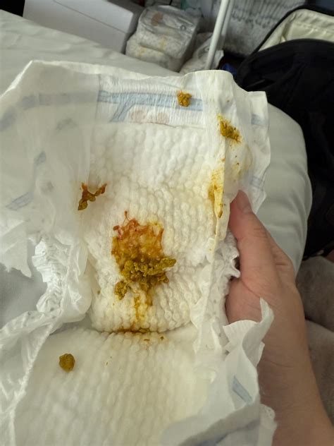 Little blood in baby poo | BabyCenter