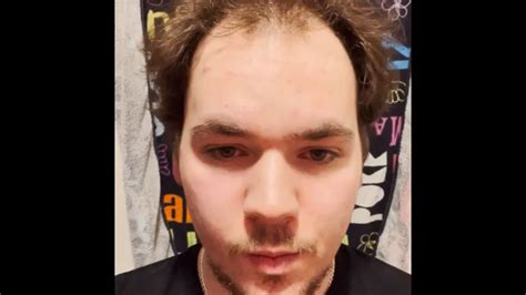 Finally mustered up the courage, thoughts? M20 : r/tressless