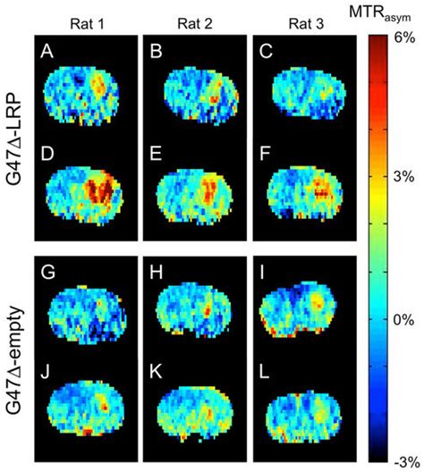 Molecular MRI-Based Monitoring of Cancer Immunotherapy Treatment Response