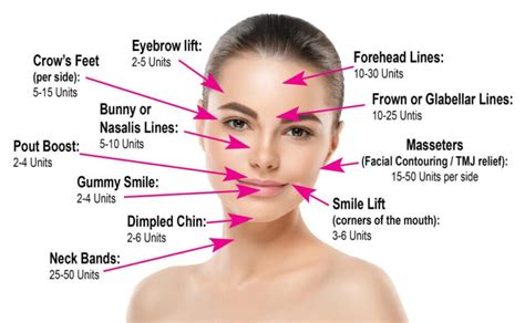 Image result for Botox Forehead Injection Sites Tutorial