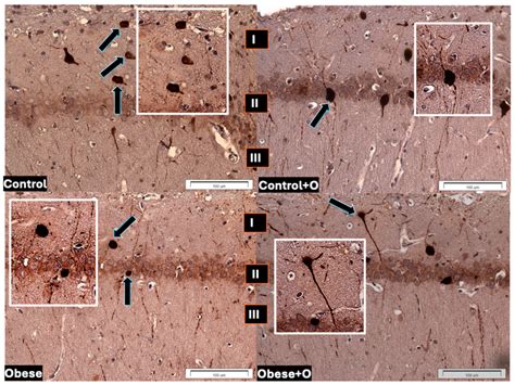 Onion Peel Powder’s Impact on the Leptin Receptors in the Hippocampus ...